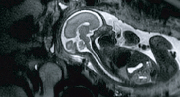 Research Topic - Child Developing Brain Institute